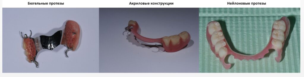Скриншот-24.05.24_14.09.01-1024x259 Cъемное протезирование